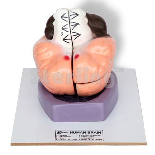 BRAIN MODEL