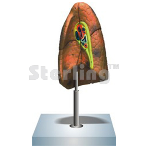 LUNG MODEL